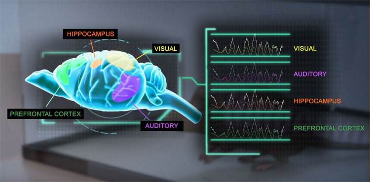A new approach to treat Alzheimer using sound and light to trigger brain waves